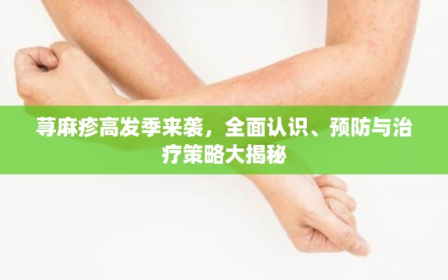 蕁麻疹高發(fā)季來襲，全面認(rèn)識、預(yù)防與治療策略大揭秘