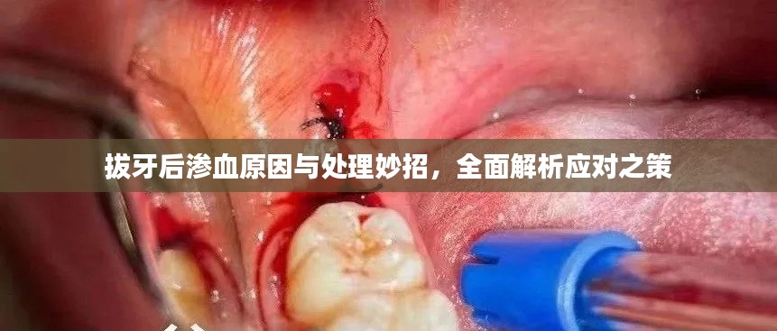 拔牙后滲血原因與處理妙招，全面解析應(yīng)對之策