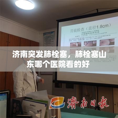 濟南突發(fā)肺栓塞，肺栓塞山東哪個醫(yī)院看的好 