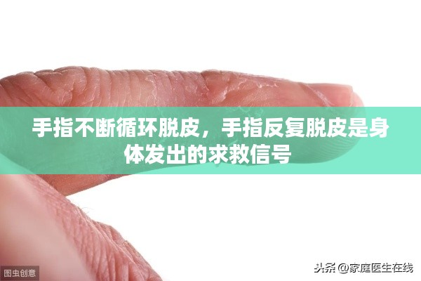 手指不斷循環(huán)脫皮，手指反復(fù)脫皮是身體發(fā)出的求救信號 