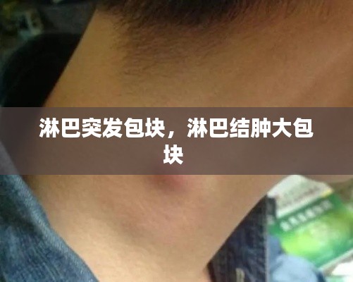 淋巴突發(fā)包塊，淋巴結(jié)腫大包塊 