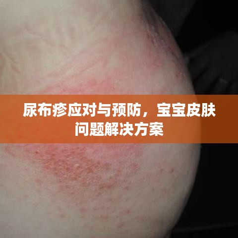 尿布疹應(yīng)對與預(yù)防，寶寶皮膚問題解決方案