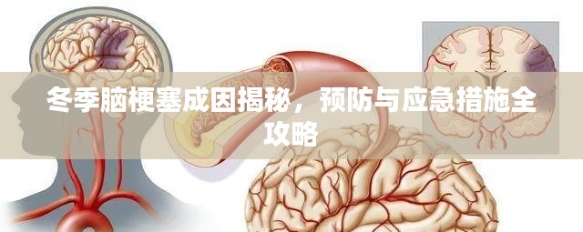 冬季腦梗塞成因揭秘，預(yù)防與應(yīng)急措施全攻略