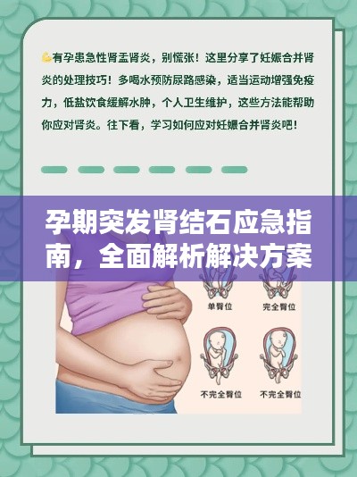 孕期突發(fā)腎結(jié)石應(yīng)急指南，全面解析解決方案