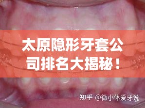 技術(shù)支持 第5頁(yè)
